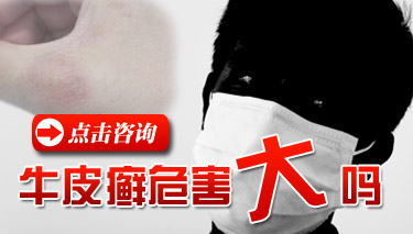 成都最好的牛皮癣专科医院地址