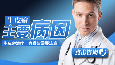 青岛专治牛皮癣医院哪家较好