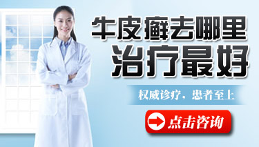 西安哪治疗银屑病效果好
