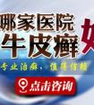 烟台医院哪家治银屑病好