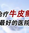 烟台哪里有治牛皮癣医院
