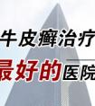 烟台专治银屑病医院哪里最好