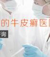 烟台哪家医院治牛皮癣效果好