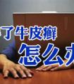 烟台治疗银屑病可以治愈吗