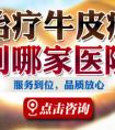 烟台牛皮癣医院哪里最好