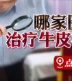 烟台治银屑病医院有哪些