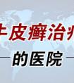 烟台哪家医院治疗牛皮癣最权威