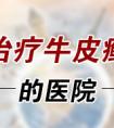 烟台最好的牛皮癣医院咨询