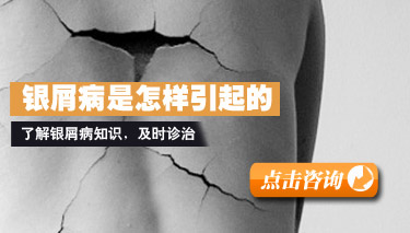 导致牛皮癣反复出现的根本原因
