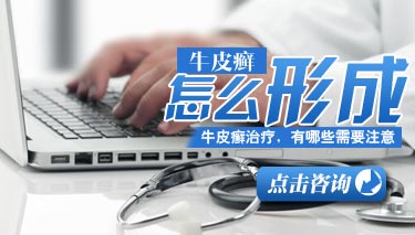 什么原因造成了儿童易患牛皮癣