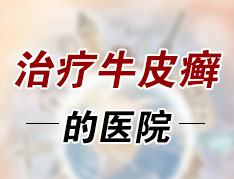 烟台省正规治疗牛皮癣医院