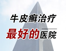 烟台银屑病医院那家好