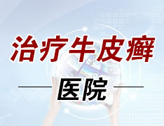 烟台银屑病治疗