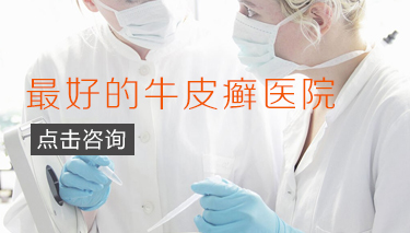 烟台牛皮癣在哪里治疗