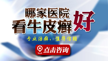 烟台银屑病医院QQ