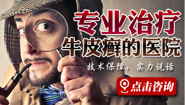 烟台哪个医院看儿童银屑病好