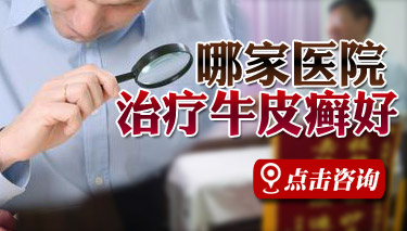 烟台治疗银屑病去哪个医院好
